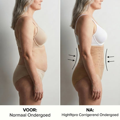 HighFitPro™ | Corrigerende afslank onderbroeken | 2+3 GRATIS
